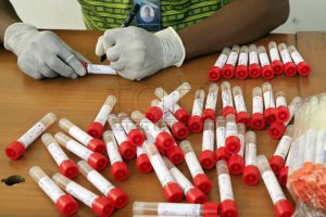 WHO-South Korea hand over 50.000 Covid-19 RDT kits to strengthen national laboratory capacity