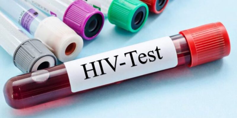 INCSIDA wants HIV/AIDS mandatory testing introduced in Universities